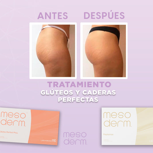 Tratamiento glúteos y caderas perfectas