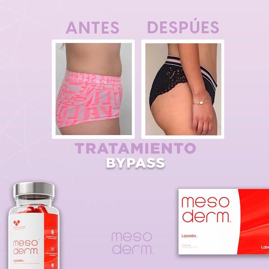 Tratamiento Bypass