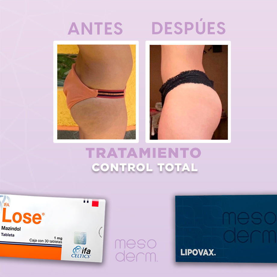 Tratamiento Control Total