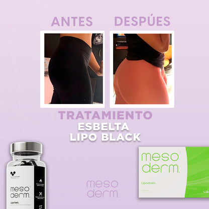 Tratamiento esbelta Lipo Black
