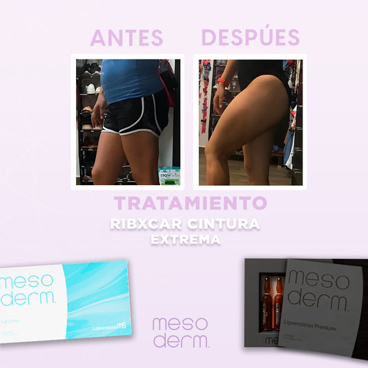 Tratamiento Ribxcar cintura extrema